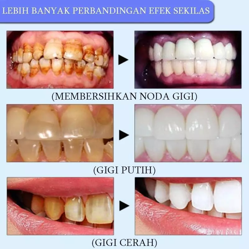 Manfaat Pasta Gigi SP4