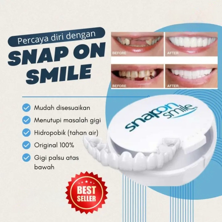 Detail Snap On Smile Material Resin